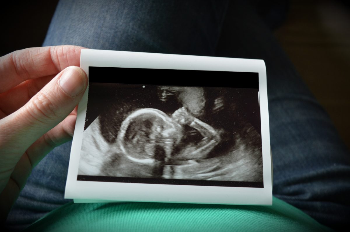 According To Planned Parenthood, Babies Who Survive Botched Abortions Deserve To Die