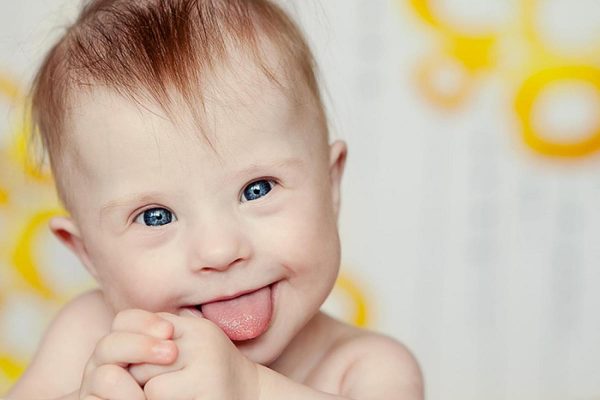 Heartbreaking: Babies With Down Syndrome Don’t Stand A Chance Under This New Law