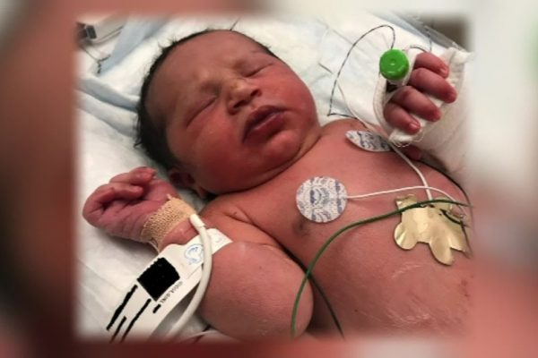 Newborn Found In A Grocery Bag Makes Remarkable Recovery